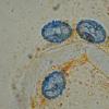 subhirtella