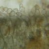 squamulosum