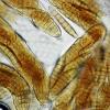 heterospora