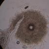 macrosporum