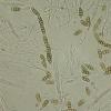 coniothyrium =Leptosphaeria coniothyrium (Fuck.)Sacc.