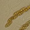 quadrinucleatum var. triseptatum