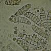 pseudotrichia
