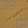 erythrostroma