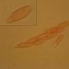 erythrostroma
