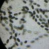 turgidum