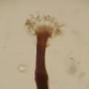 aphtosae