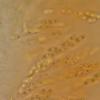 confertula
