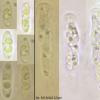 grevillei