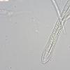 pseudofarinacea