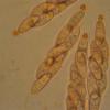 conformis