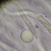 microspora