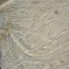 caliciforme