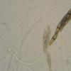 applanatum