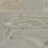 sphinctrinaeformis