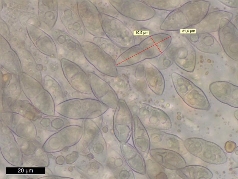 macrostoma