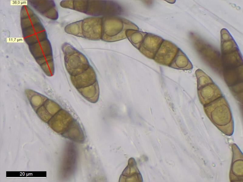 macrostoma