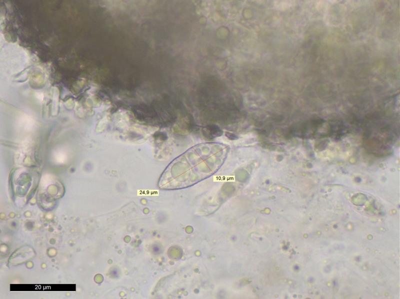 macrostoma