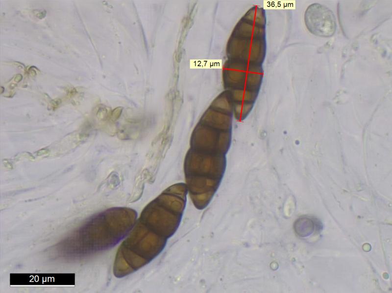 macrostoma