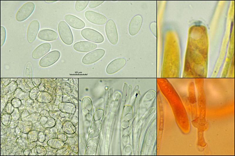 macrostoma