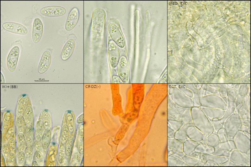 macrostoma