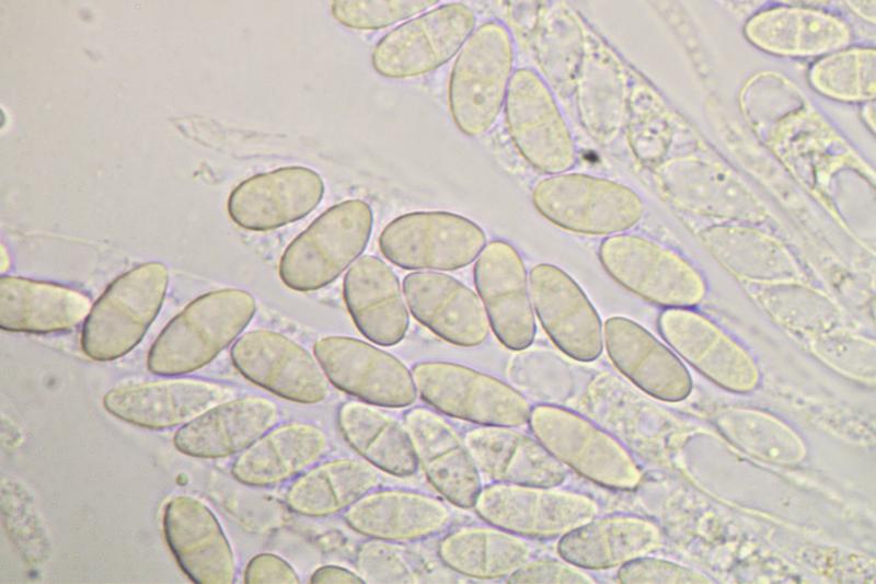 macrostoma