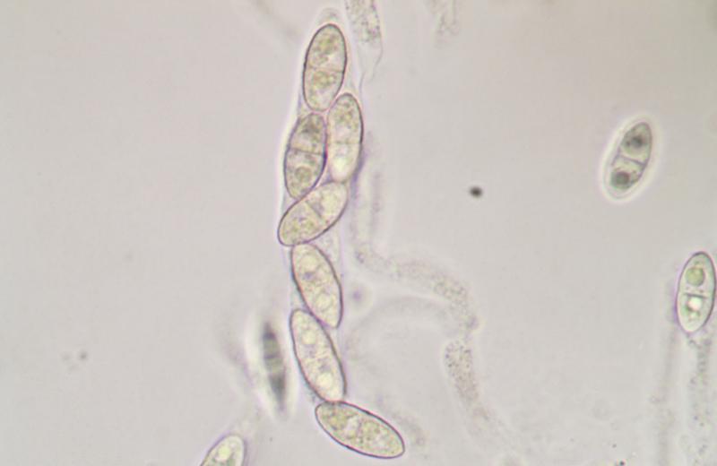 macrostoma