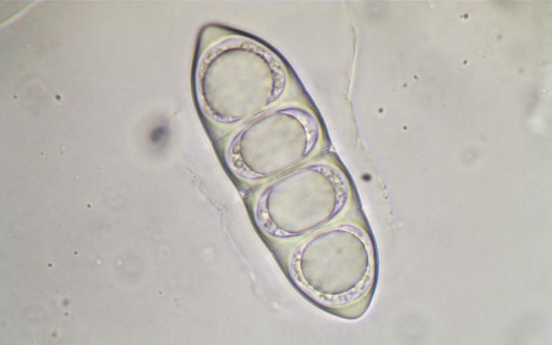 macrostoma