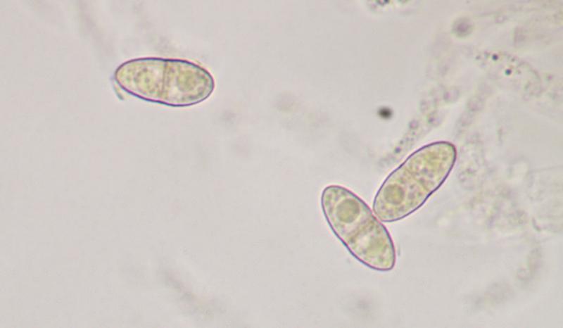 macrostoma