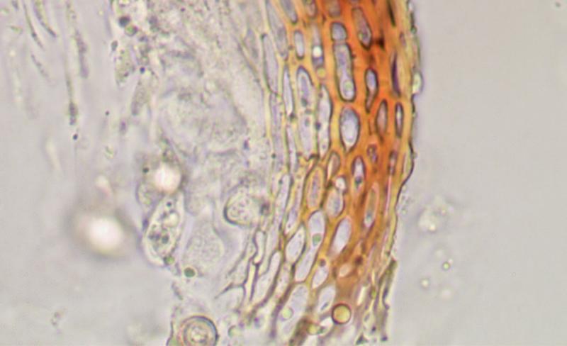 macrostoma