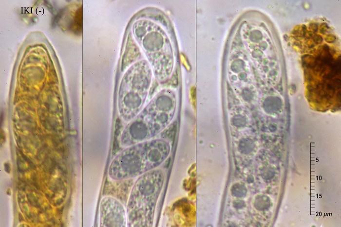 macrostoma