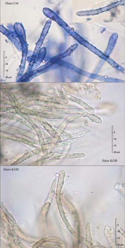 macrostoma