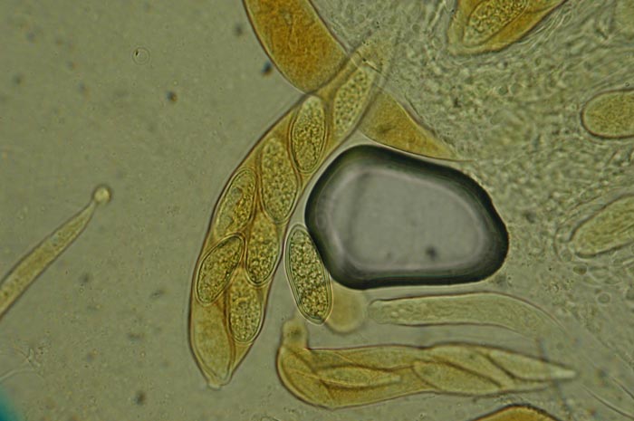 macrostoma
