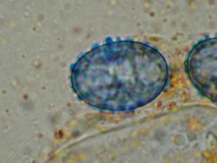 macrostoma