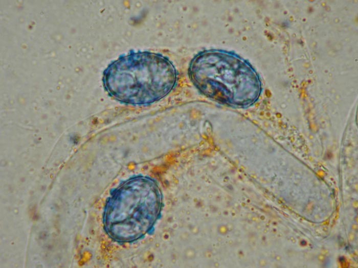 macrostoma