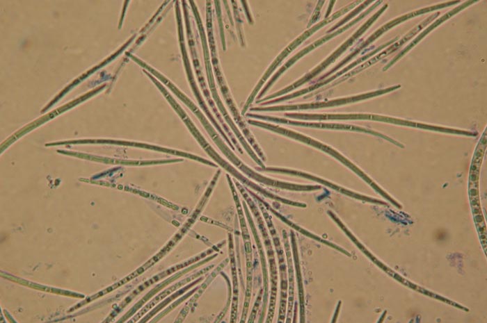 macrostoma