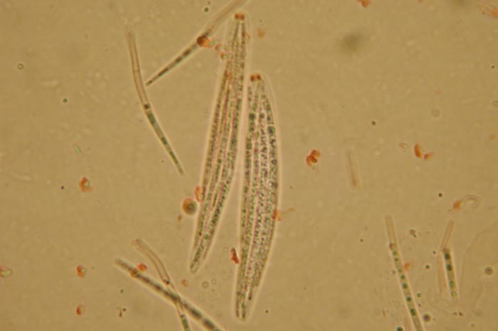 macrostoma