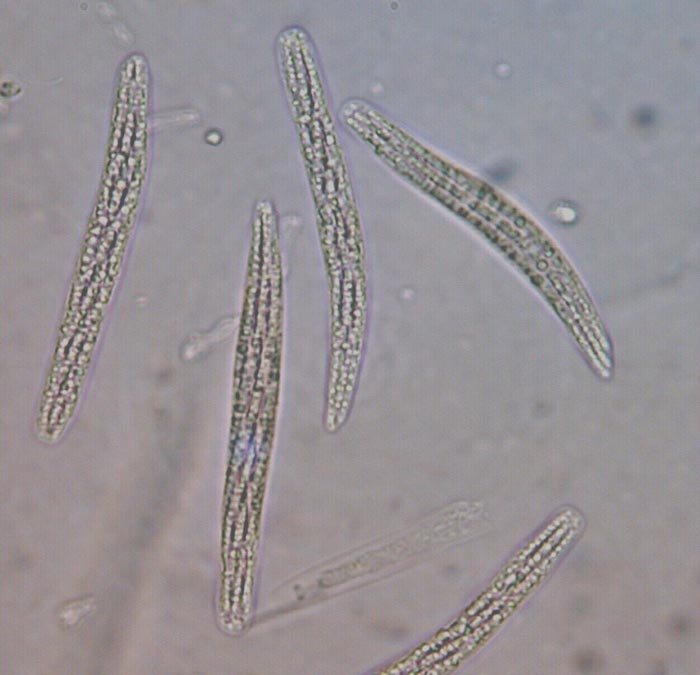 macrostoma