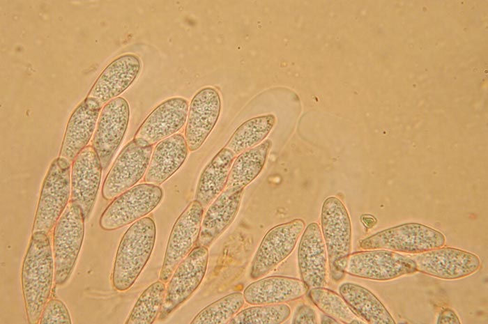 macrostoma