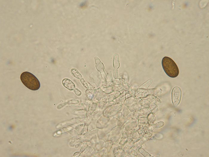 macrostoma