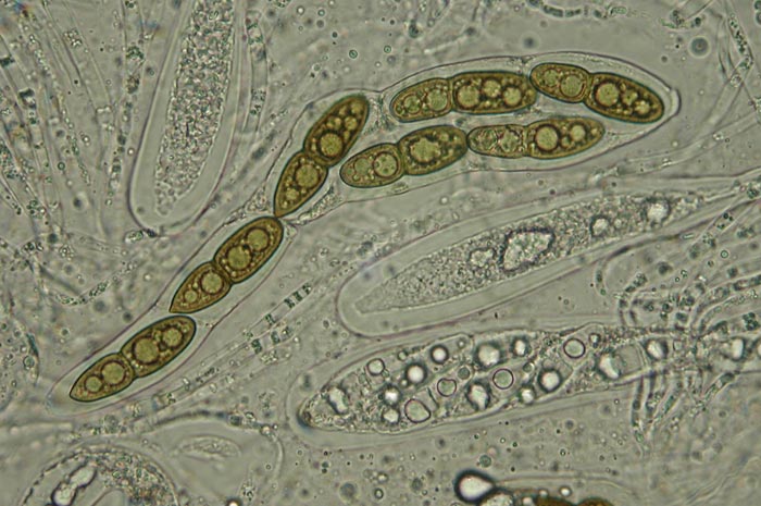 macrostoma