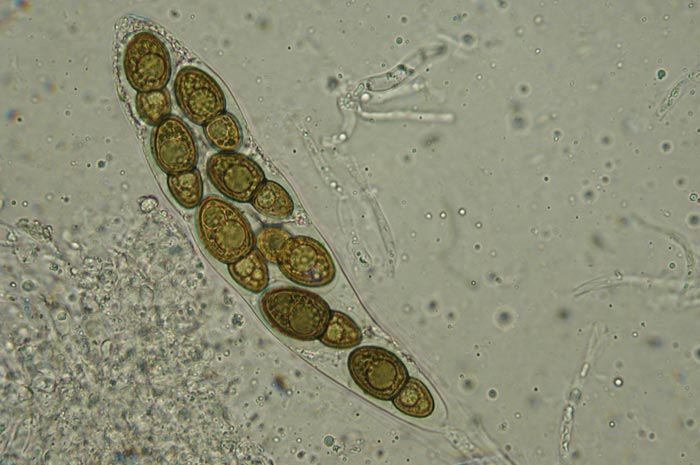 macrostoma