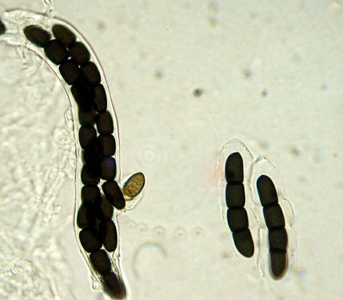 macrostoma