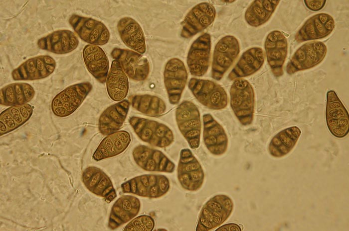 macrostoma