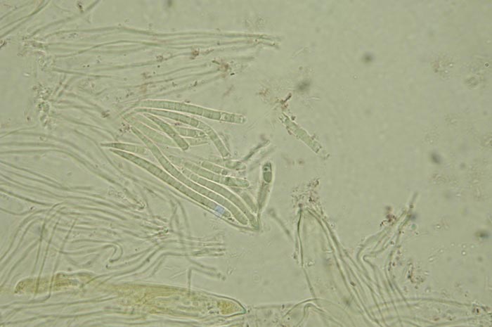 macrostoma
