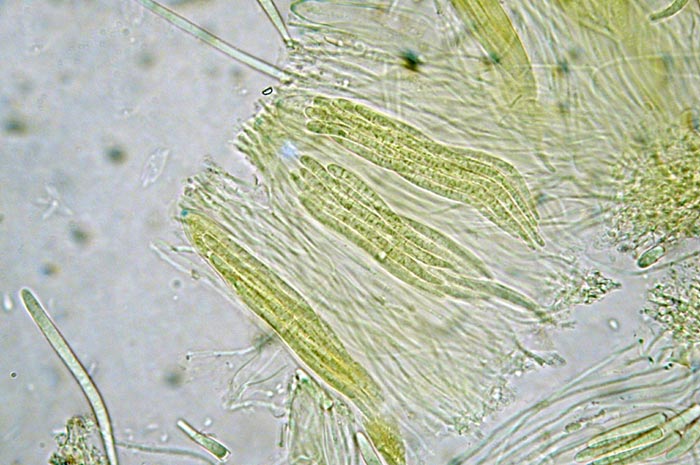 macrostoma