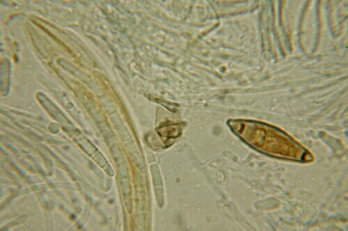 macrostoma