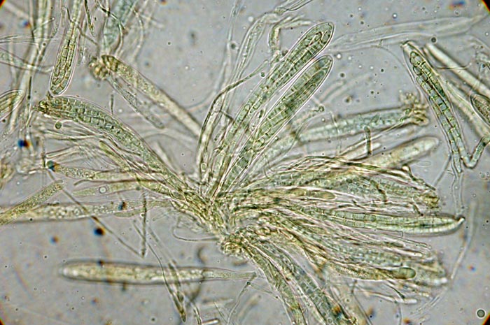 macrostoma