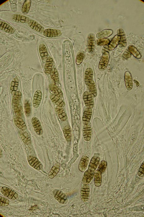 macrostoma