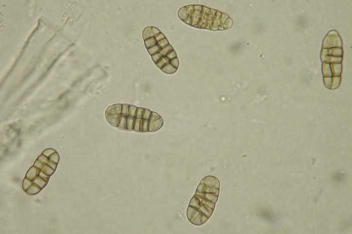 macrostoma